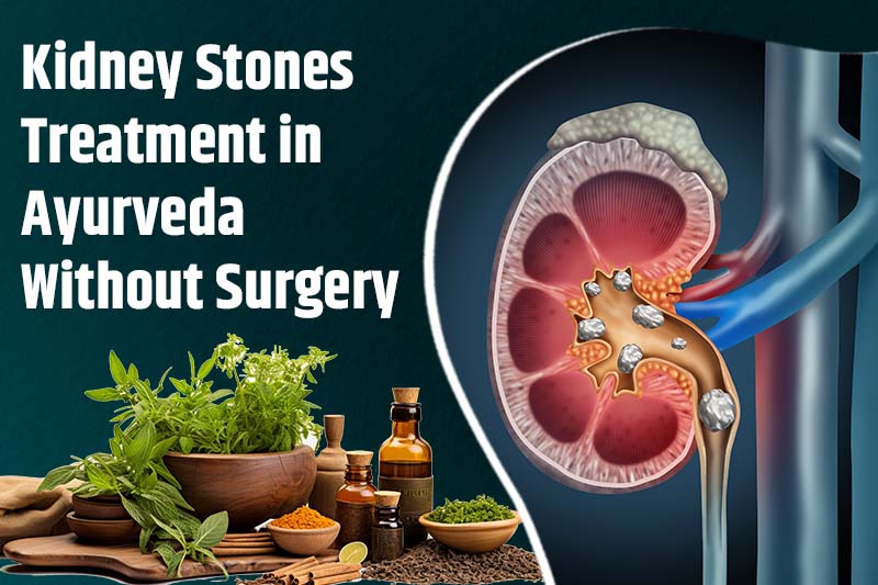 Kidney Stones Treatment in Ayurveda Without Surgery